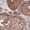 ADP Ribosylation Factor Like GTPase 13B antibody, NBP2-14312, Novus Biologicals, Immunohistochemistry frozen image 