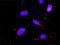 Mitogen-Activated Protein Kinase Kinase 5 antibody, H00005607-M03, Novus Biologicals, Proximity Ligation Assay image 