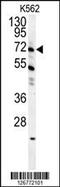 Growth Arrest Specific 2 Like 1 antibody, 55-100, ProSci, Western Blot image 