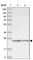 VPS28 Subunit Of ESCRT-I antibody, HPA024745, Atlas Antibodies, Western Blot image 