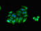 Myosin light chain kinase, smooth muscle antibody, LS-C682218, Lifespan Biosciences, Immunofluorescence image 