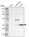 MNAT1 Component Of CDK Activating Kinase antibody, PA5-51443, Invitrogen Antibodies, Western Blot image 