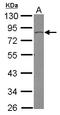 Sorbin And SH3 Domain Containing 3 antibody, LS-C155413, Lifespan Biosciences, Western Blot image 