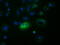 Follicle Stimulating Hormone Subunit Beta antibody, LS-C115549, Lifespan Biosciences, Immunofluorescence image 