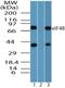 Eukaryotic Translation Initiation Factor 4B antibody, NBP2-24475, Novus Biologicals, Western Blot image 