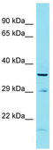 Family With Sequence Similarity 170 Member B antibody, TA335887, Origene, Western Blot image 