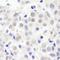 SMG8 Nonsense Mediated MRNA Decay Factor antibody, A301-471A, Bethyl Labs, Immunohistochemistry frozen image 
