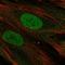 PHD Finger Protein 11 antibody, HPA016566, Atlas Antibodies, Immunofluorescence image 