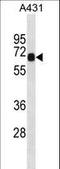 Dynein Axonemal Intermediate Chain 2 antibody, LS-C157687, Lifespan Biosciences, Western Blot image 