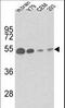 Tubulin Beta 1 Class VI antibody, LS-C161721, Lifespan Biosciences, Western Blot image 