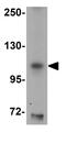 Sirtuin 1 antibody, GTX85106, GeneTex, Western Blot image 