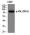Lipase E, Hormone Sensitive Type antibody, P06762, Boster Biological Technology, Western Blot image 