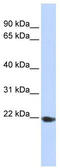 Transmembrane P24 Trafficking Protein 1 antibody, TA341867, Origene, Western Blot image 