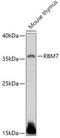 RNA Binding Motif Protein 7 antibody, orb543854, Biorbyt, Western Blot image 