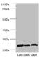 Ribosomal Protein L9 antibody, LS-C676423, Lifespan Biosciences, Western Blot image 