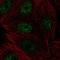 ZMYND4 antibody, HPA062423, Atlas Antibodies, Immunofluorescence image 