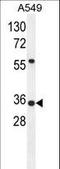 Sosondowah Ankyrin Repeat Domain Family Member D antibody, LS-C156355, Lifespan Biosciences, Western Blot image 