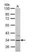 Cytochrome B5 Reductase 1 antibody, GTX119589, GeneTex, Western Blot image 