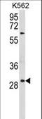 Uroplakin 1B antibody, LS-C160448, Lifespan Biosciences, Western Blot image 