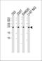 Ubiquitin C-Terminal Hydrolase L3 antibody, MBS9206105, MyBioSource, Western Blot image 