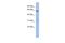 General Transcription Factor IIF Subunit 1 antibody, A08313, Boster Biological Technology, Western Blot image 