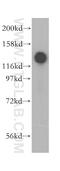 Scaffold Attachment Factor B2 antibody, 11642-1-AP, Proteintech Group, Western Blot image 