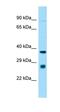 ST8 Alpha-N-Acetyl-Neuraminide Alpha-2,8-Sialyltransferase 1 antibody, orb325216, Biorbyt, Western Blot image 