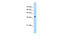 Chromobox protein homolog 6 antibody, MBS832155, MyBioSource, Western Blot image 