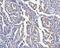 PDZ And LIM Domain 7 antibody, A04377-1, Boster Biological Technology, Immunohistochemistry paraffin image 