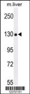 Collagen Type XVIII Alpha 1 Chain antibody, 55-358, ProSci, Western Blot image 