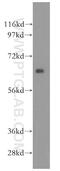 Hexosaminidase Subunit Beta antibody, 16229-1-AP, Proteintech Group, Western Blot image 