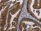 MAGE Family Member B3 antibody, CSB-PA225412, Cusabio, Immunohistochemistry paraffin image 