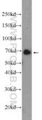 Ankyrin Repeat Domain 55 antibody, 24203-1-AP, Proteintech Group, Western Blot image 