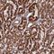 Proteasome 26S Subunit, Non-ATPase 2 antibody, HPA045192, Atlas Antibodies, Immunohistochemistry paraffin image 