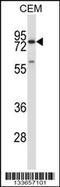 Matrix Metallopeptidase 16 antibody, 57-216, ProSci, Western Blot image 