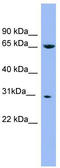 NADH:Ubiquinone Oxidoreductase Core Subunit S3 antibody, TA342217, Origene, Western Blot image 