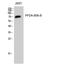 Protein Phosphatase 2 Regulatory Subunit B'Delta antibody, STJ95194, St John