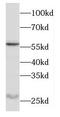 Outer Dense Fiber Of Sperm Tails 1 antibody, FNab05970, FineTest, Western Blot image 