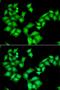Aladin WD Repeat Nucleoporin antibody, LS-C335665, Lifespan Biosciences, Immunofluorescence image 