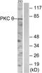 Protein Kinase C Theta antibody, LS-B11309, Lifespan Biosciences, Western Blot image 