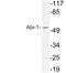 Abl Interactor 1 antibody, LS-C177589, Lifespan Biosciences, Western Blot image 