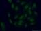 General transcription factor IIE subunit 2 antibody, 11596-1-AP, Proteintech Group, Immunofluorescence image 