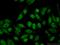 RNA Binding Motif Protein 3 antibody, 14363-1-AP, Proteintech Group, Immunofluorescence image 