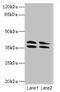 Carbonic Anhydrase 10 antibody, LS-C677354, Lifespan Biosciences, Western Blot image 