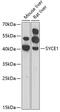 Synaptonemal Complex Central Element Protein 1 antibody, 22-791, ProSci, Western Blot image 