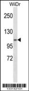 Zinc Finger Protein 836 antibody, 57-163, ProSci, Western Blot image 