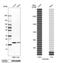 Coiled-coil-helix-coiled-coil-helix domain-containing protein 2, mitochondrial antibody, PA5-55602, Invitrogen Antibodies, Western Blot image 