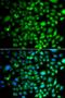 Protein Tyrosine Kinase 6 antibody, orb248028, Biorbyt, Immunofluorescence image 