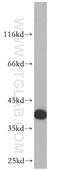 RP2 Activator Of ARL3 GTPase antibody, 14151-1-AP, Proteintech Group, Western Blot image 