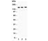 Apoptotic Peptidase Activating Factor 1 antibody, R30355, NSJ Bioreagents, Western Blot image 